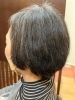 医療用ロケットトリートメント施術後「抗がん剤治療後の髪の悩み・ヘアカラーの刺激が心配なあなたへ」