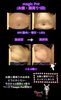 magic Potお腹周り結果「感謝月間前の期間限定プレ企画(10月お得エステ)」