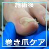 二枚爪からの補正　No.88-4「二枚爪からの補正　No.88」