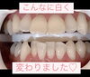 メディカルホワイトニング「メディカルホワイトニング」