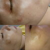「しみ、しわ、たるみ、毛穴に効果絶大ｴｽﾃ3980円」