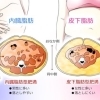 皮下脂肪を落とすには根気よく続けること【女性専用】24時間ジム