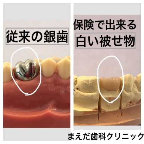 「素敵な笑顔は口元から♩」