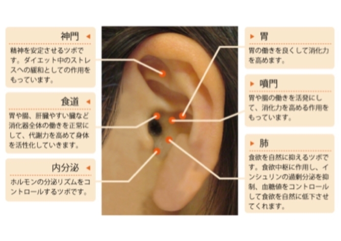 「施術紹介：耳つぼ」