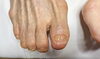 人工爪の一例「人工爪」