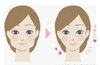 「口腔内の癒着で雲泥の差！」