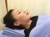 「美容鍼とは？」