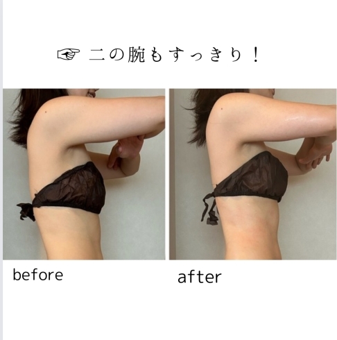 before ⇨after「オーダーメイドボディbefore ⇨after  《当別エステ/リラクゼーション/ボディトリートメント》」