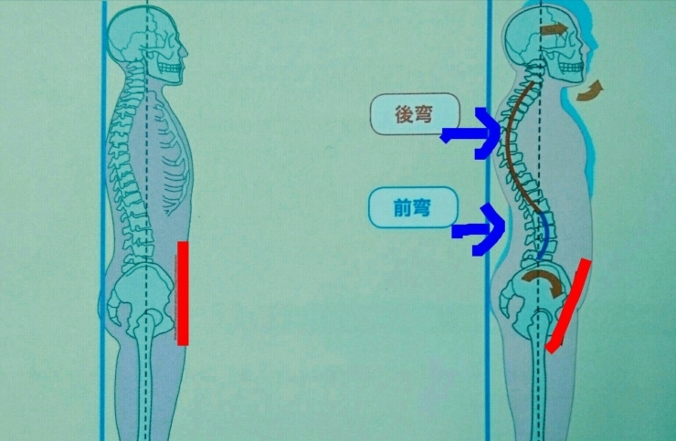 「姿勢のチェックからエクササイズへ！」