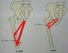 股関節痛にはこの筋肉をチェック コンディショニングルーム からだサポートのニュース まいぷれ 松江