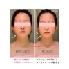 頭がい骨小顔矯正 ご感想 美容整体エステ 花音のニュース まいぷれ 花巻 北上 一関 奥州