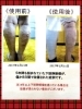 下肢静脈瘤のビフォーアフター！「サポーターに革命を！！」