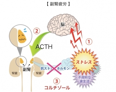 「血糖値の高さとストレス」