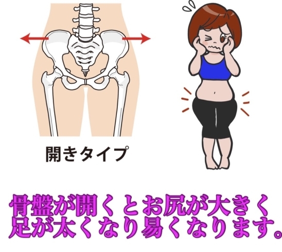 骨盤が開くとお尻が大きく足が太くなり易くなります | カイロ