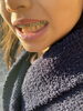 今回のテーマはTanjiro』「矯正は楽しく♪かわいく♪ 見せてこ♫」