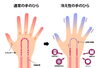 はりきゅうも振動も気血をめぐらすためのものです♪「［セルフケア機器・DODONPAご利用の方へ］楽天シニアアプリからのお申し込みで楽天10ポイントgetできます♪」