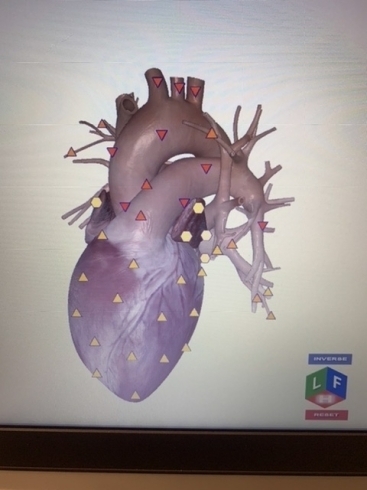 心臓の臓器測定「4Dとは？」