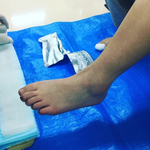 「足首の捻挫の処置対応」