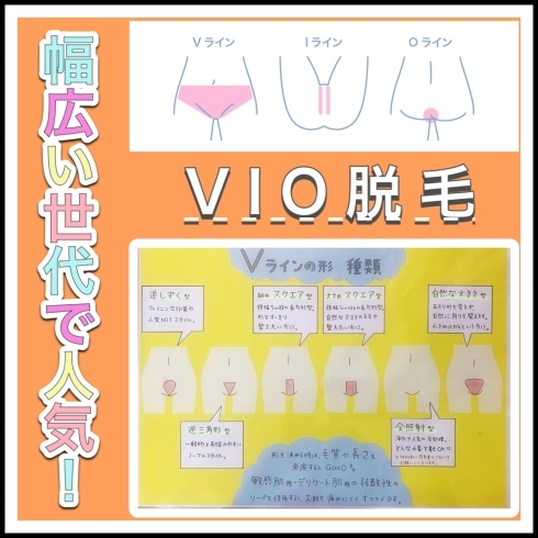 「VIO脱毛について❗️」