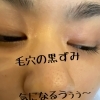 毛穴の黒ずみはクレンジングでも洗顔でも落ちません 炭酸ジェルでケアします 江戸川区小岩の女性のお顔剃り 透明美白肌 Ca Nata ヘア リラックスのニュース まいぷれ 江戸川区