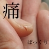 ハンドケア パックリあかぎれさようなら 美爪を追求 ケア重視 福井のネイルサロン Nail Melia Medical Healthcare のニュース まいぷれ 福井