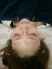 美人鍼「初めの一歩✨」