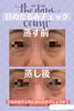 目の下のたるみでお悩みの方！40分でここまで！「♨️よもぎ湯を江戸川区で手軽に♨️」