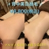 「背中美白脱毛！¥8,800(税込)」