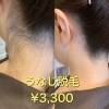 「うなじ脱毛¥3,300(税込)✨✨」