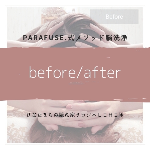 脳洗浄®︎4回終了のお客様「脳洗浄で肩の歪みも変わるの⁉︎ 【脳がとろけそうなほど気持ちいい・宮崎上陸・PARAFUSE.・脳洗浄®︎・LIHI】」