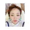 「7月の美容鍼DAY✨」