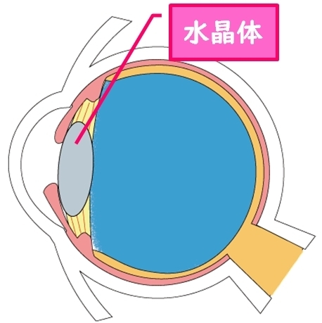 目の中の水晶体が濁ると視力低下や眩しさを招きます「白内障によるツラい眩しさを和らげるサングラス　〜遮光眼鏡をご存知ですか？〜」