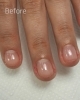 他店で自爪育成失敗した人 あきらめないで 福井市 ネイルサロン 自爪育成 Nail Melia Medical Healthcare のニュース まいぷれ 福井 他店で自爪育成失敗した人 あきらめないで 福井市 ネイルサロン 自爪育成 Nail Melia Medical Healthcare のニュース まいぷれ 福井