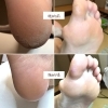 足の角質うるおいケア（トラブルの少ない方用　約60分）