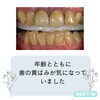 before「メディカルホワイトニングで白く輝く“自慢の歯”へ」