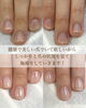 健康的な爪へ導く施術「爪の色と育成【福井/自爪育成/健康な爪へ】」
