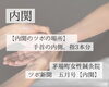 【ツボ新聞】つわりだけでなく、車酔いにも効果的なツボ「内関」「【ツボ新聞】つわりだけでなく、車酔いにも効果的なツボ「内関」」