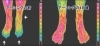 アーシングは冷え性の方にも良いのかもしれませんね。「新しいワード「アーシング(Earthing)」 皆さんご存じでしたか?」