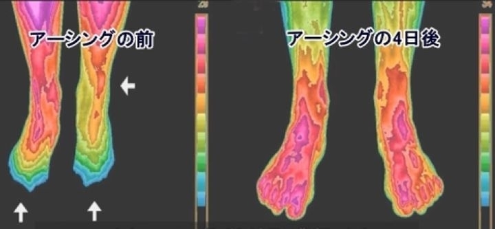 アーシングは冷え性の方にも良いのかもしれませんね。「新しいワード「アーシング（Earthing）」　　　皆さんご存じでしたか？」