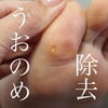 「足のトラブルはプロにお任せ！うおのめ除去☆【福井市　ネイルサロン】」