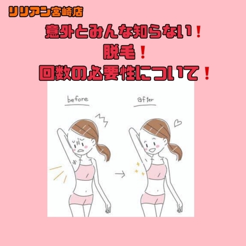 「脱毛❗️回数の必要性について❗️」