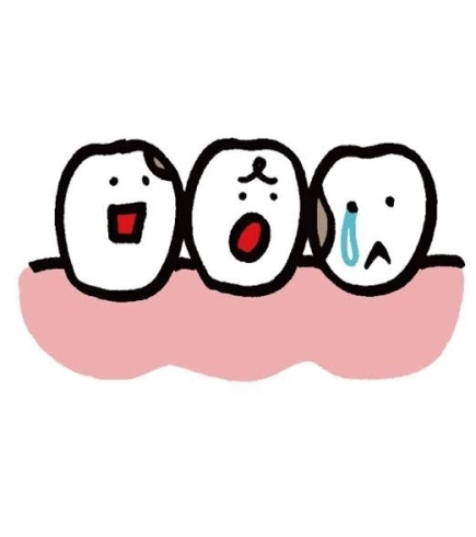 「プラーク(汚れ)は歯だけではなかった！！#プラーク#汚れ#歯の汚れ#脳疾患」