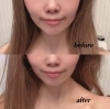 ハイフって凄いんですっ 二重アゴ ほうれい線 たるみ シワの悩みもスッキリ解決 小顔美人に ビューティサロンlily リリィ ビューティーサロン Lily リリィ のニュース まいぷれ 春日井市