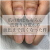 「爪の育成だけじゃない！手元丸ごとキレイに☆【福井市 / ネイルサロン / メディカルネイルプランナー】」