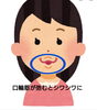 アヒル口をするとシワシワに…「アヒル口するとシワシワな口角(;O;)　何歳頃から口輪筋が衰えるの？空き状況最新版アップ！！」