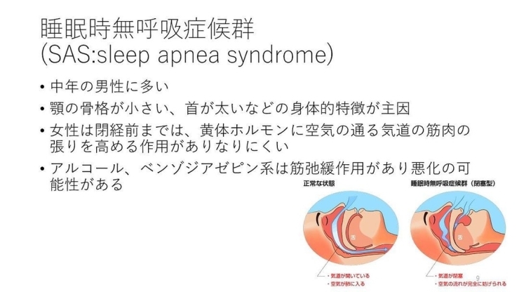 「【睡眠時無呼吸症候群】【行徳・南行徳で充実プログラムのパーソナルトレーニングジム】」