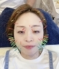 「10月の美容鍼Day♡」