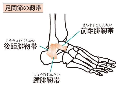 「捻挫とは」