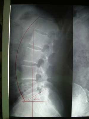 「腰痛 注意報です」