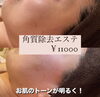 「お肌の角質問題！解決！」